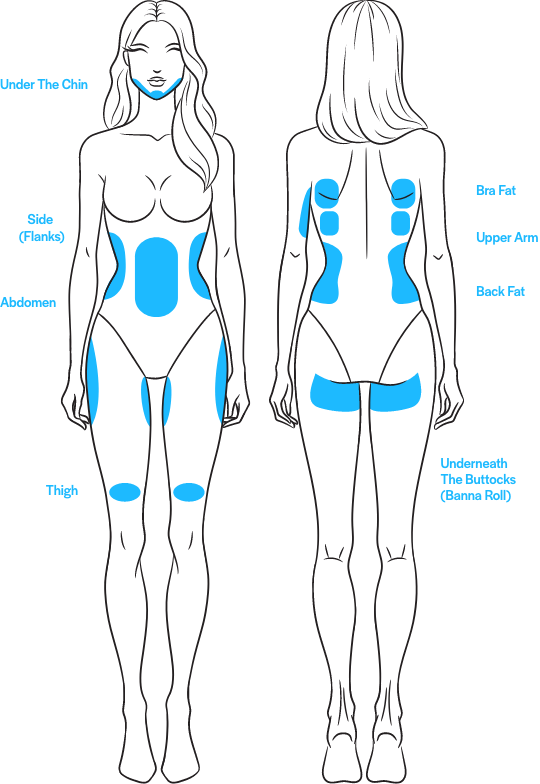 coolsculpting infographic