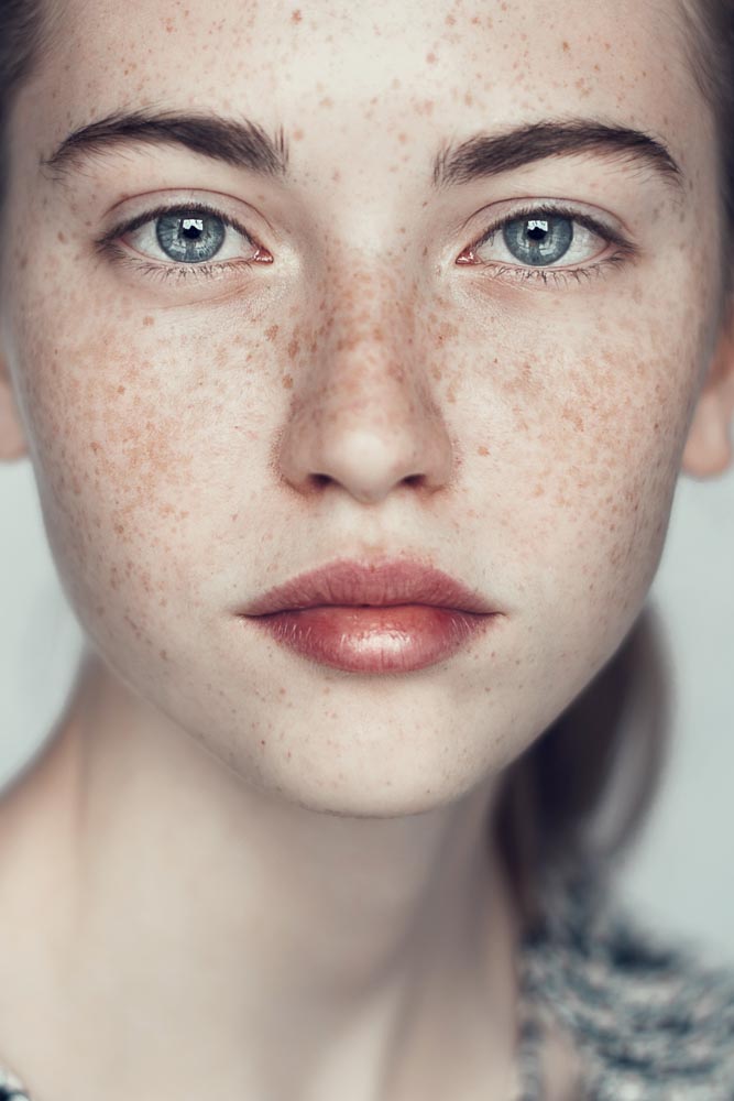 Peel Pretty this Summer | RefinedMD, Los Gatos + San Jose
