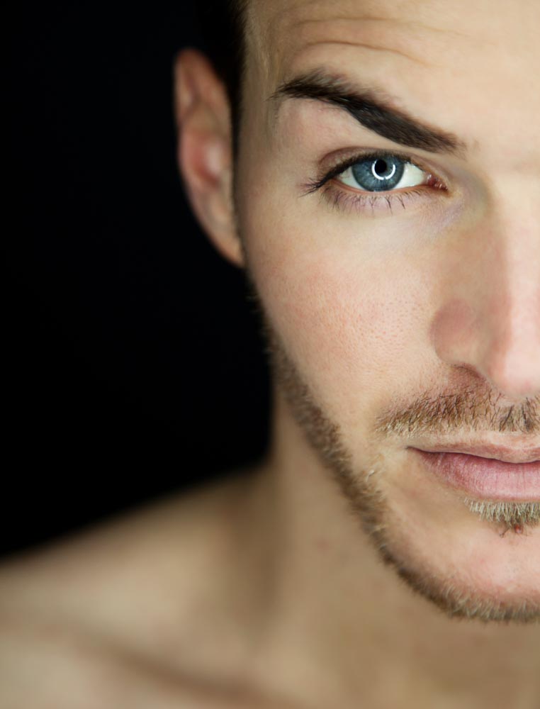 Microneedling Taps Your Body’s Healing Powers | RefinedMD, San Jose