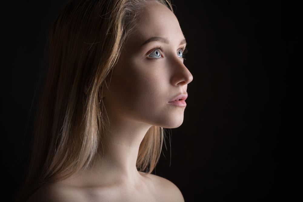 Fractional Resurfacing | RefinedMD, Los Gatos + San Jose