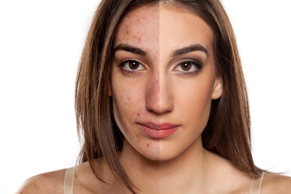 Sun Damage: Is It Too Late? | RefinedMD, Los Gatos + San Jose