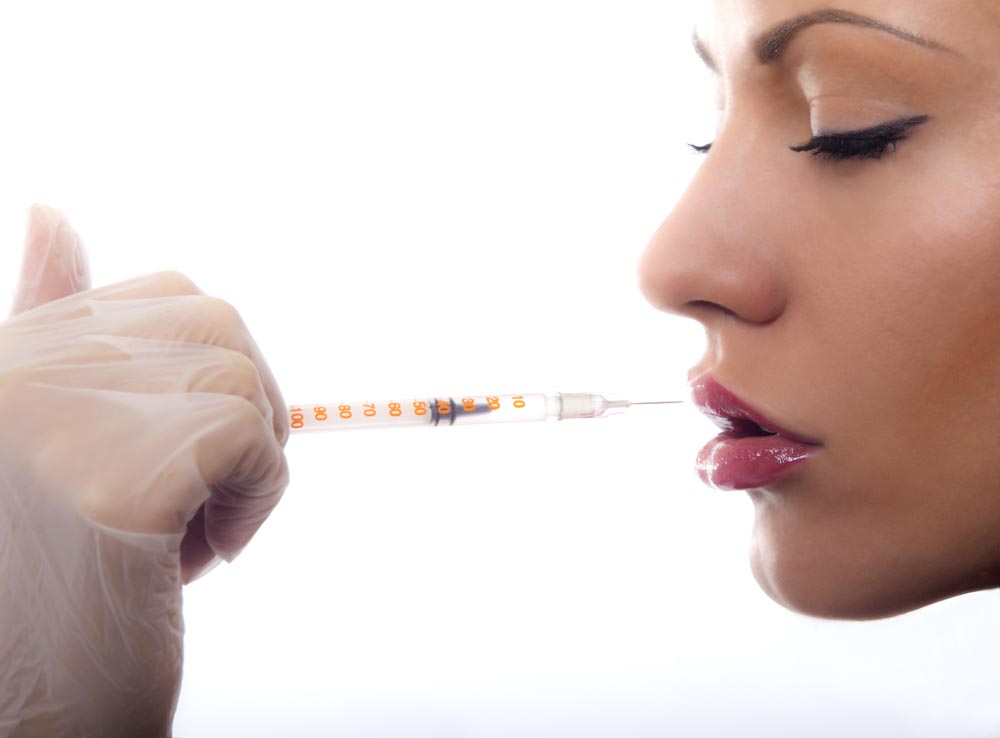 Dermal Fillers, San Jose | RefinedMD, Los Gatos + San Jose