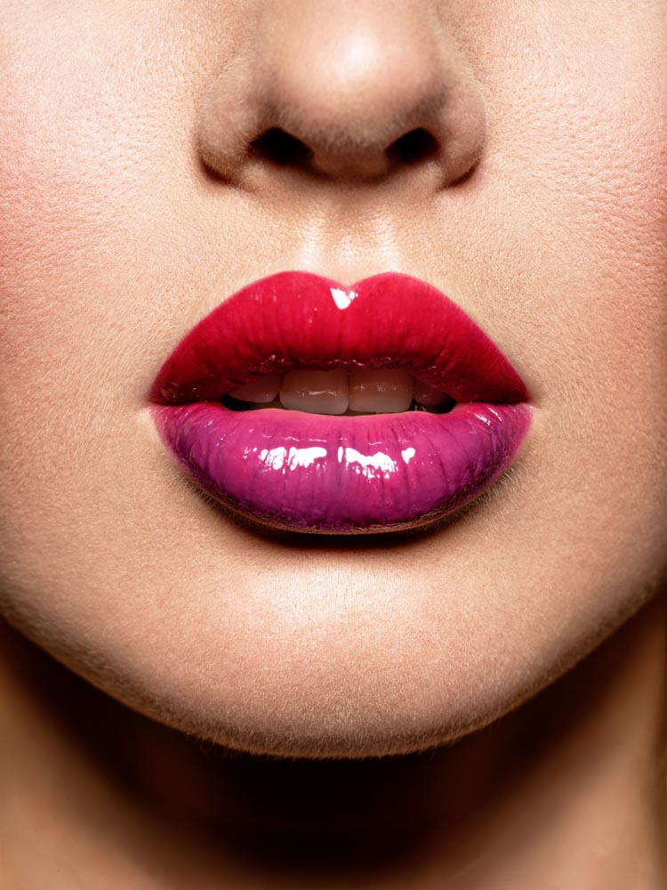 Lip Augmentation vs. Lip Fillers | RefinedMD, Los Gatos