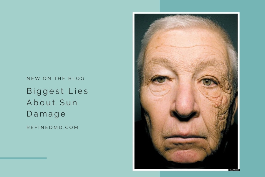 Biggest Lies About Sun Damage | RefinedMD, Los Gatos + San Jose