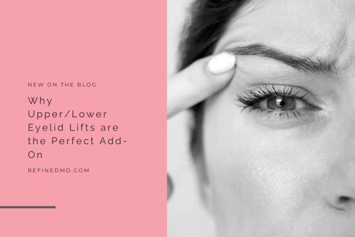 Why Upper/Lower Eyelid Lifts are the Perfect Add-On - RefinedMD
