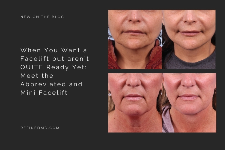 Meet the Abbreviated and Mini Facelift | RefinedMD, Los Gatos + San Jose