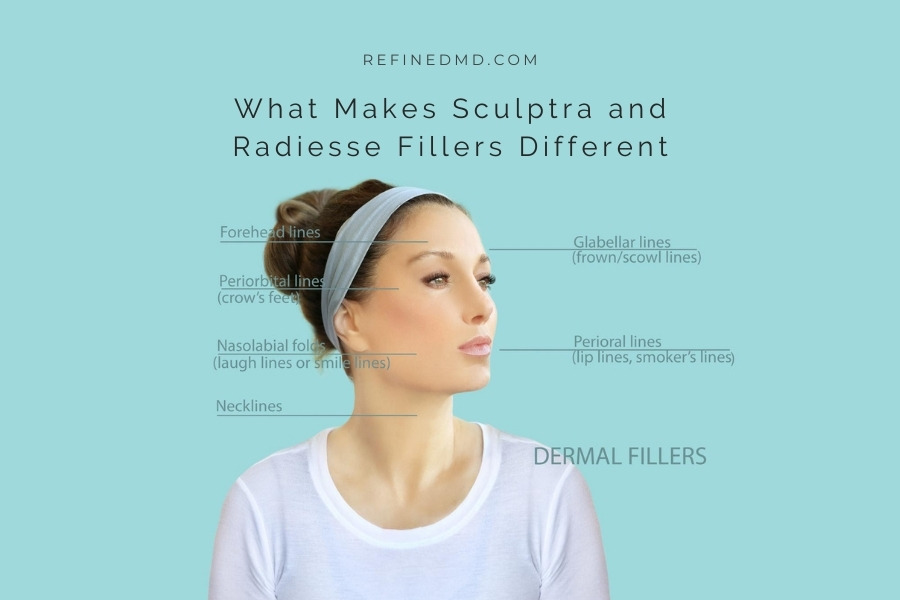 What Makes Sculptra and Radiesse Fillers Different | RefinedMD