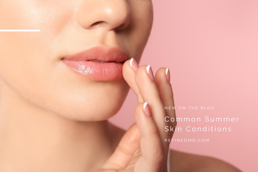 Common Summer Skin Conditions | RefinedMD, Los Gatos