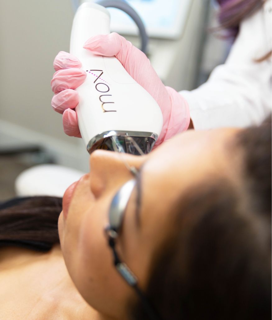 Laser device applied to woman's face with protective eye shields
