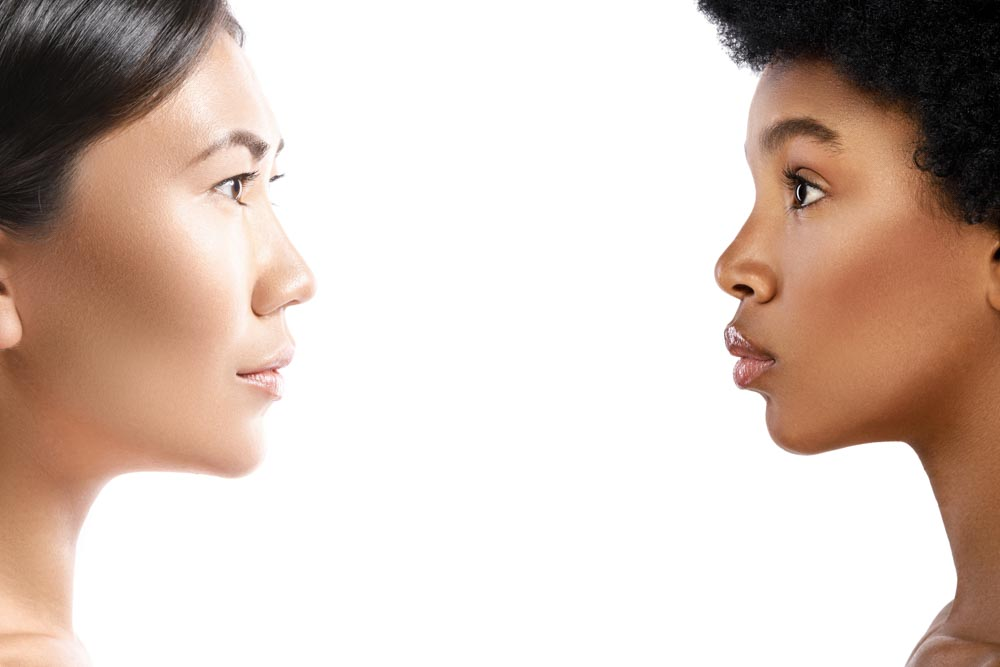Visia Complexion Analysis