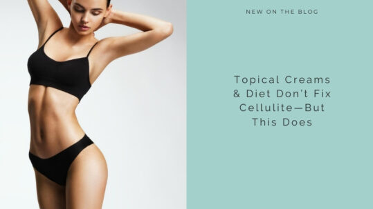 Creams & Diet Don’t Fix Cellulite | RefinedMD, Los Gatos + San Jose