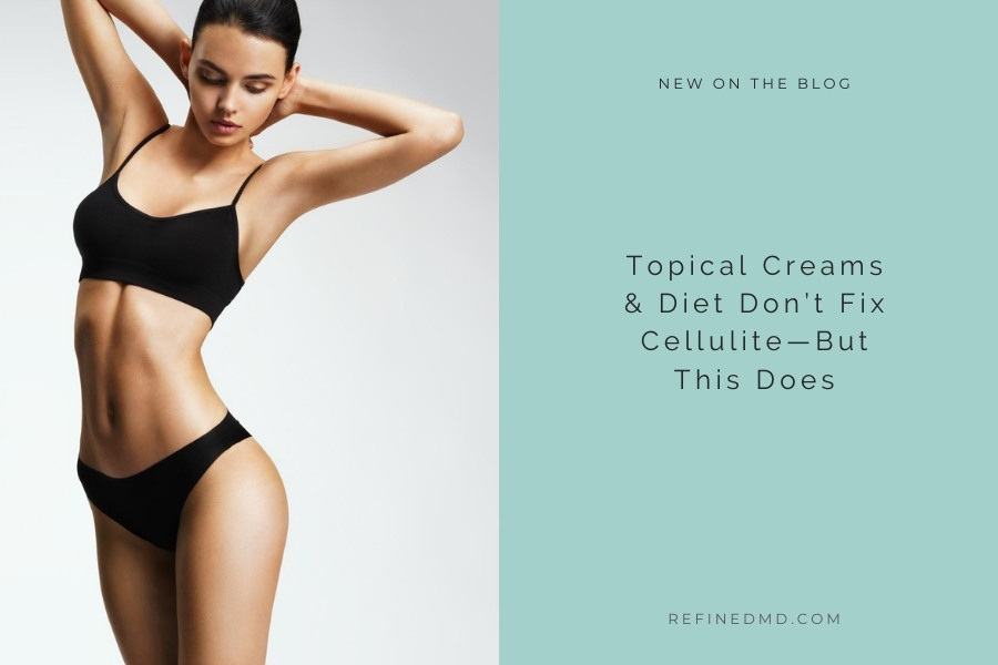 Creams & Diet Don’t Fix Cellulite | RefinedMD, Los Gatos + San Jose