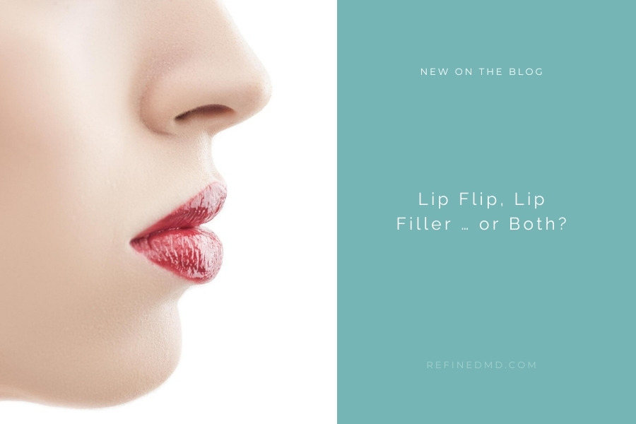 Lip Flip, Lip Filler … or Both? | RefinedMD, Los Gatos + San Jose