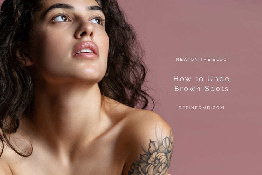How to Undo Brown Spots | RefinedMD, Los Gatos + San Jose