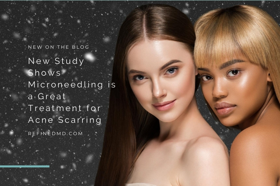 Microneedling is a Great Treatment for Acne Scarring | RefinedMD