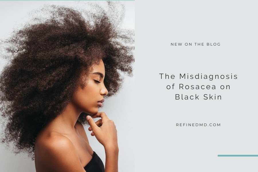 The Misdiagnosis of Rosacea on Black Skin | RefinedMD, Los Gatos