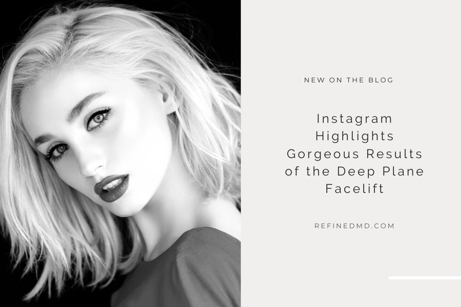 Gorgeous Results of the Deep Plane Facelift | RefinedMD