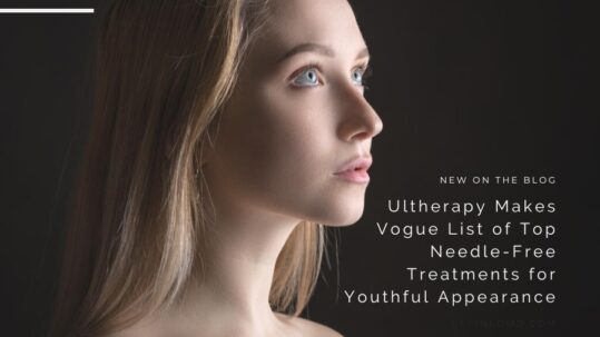 Ultherapy Top Needle-Free Treatments | RefinedMD, Los Gatos